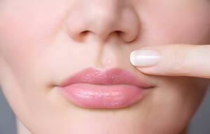 Pimple on lip 